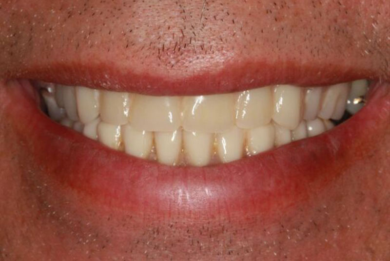 After